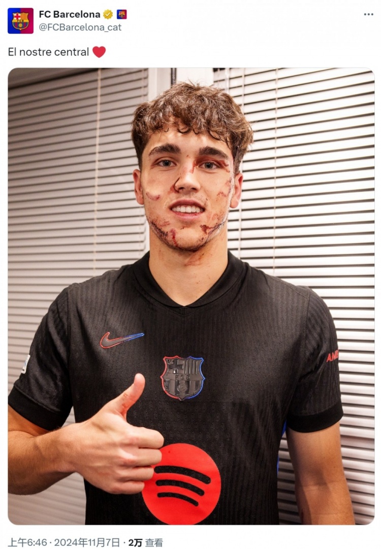 每体:脸部受伤的库巴西想出战本轮西甲,巴萨将谨慎做决定