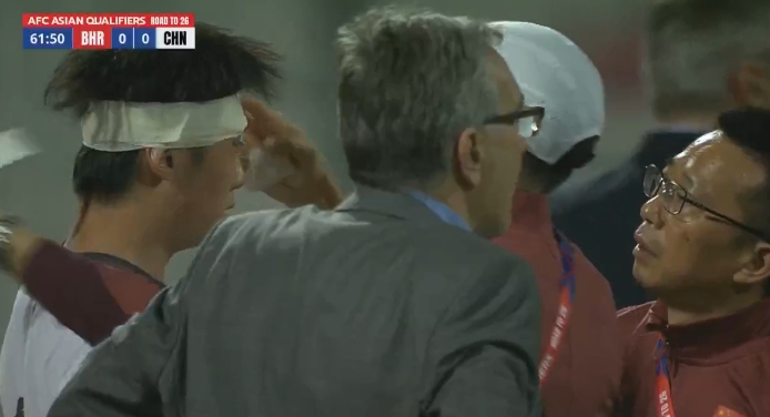 徐皓阳在昨天比赛中眉骨开裂&赛后第一时间缝针,伤口不小